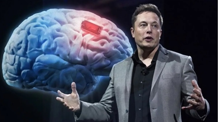 Bilionário Elon Musk anuncia primeiro implante de chip da Neuralink que conecta cérebro humano a computador